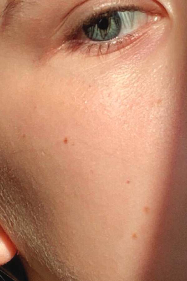 After 4 weeks