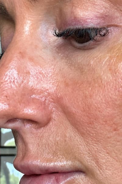 After 8 weeks